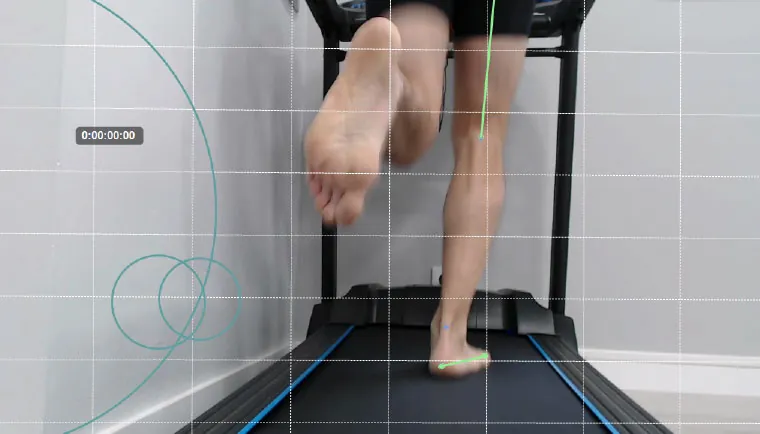 Estudio de la pisada en cinta con análisis de vídeo en AthletePro Madrid